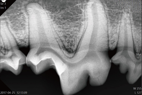 動物用デジタルX線センサー